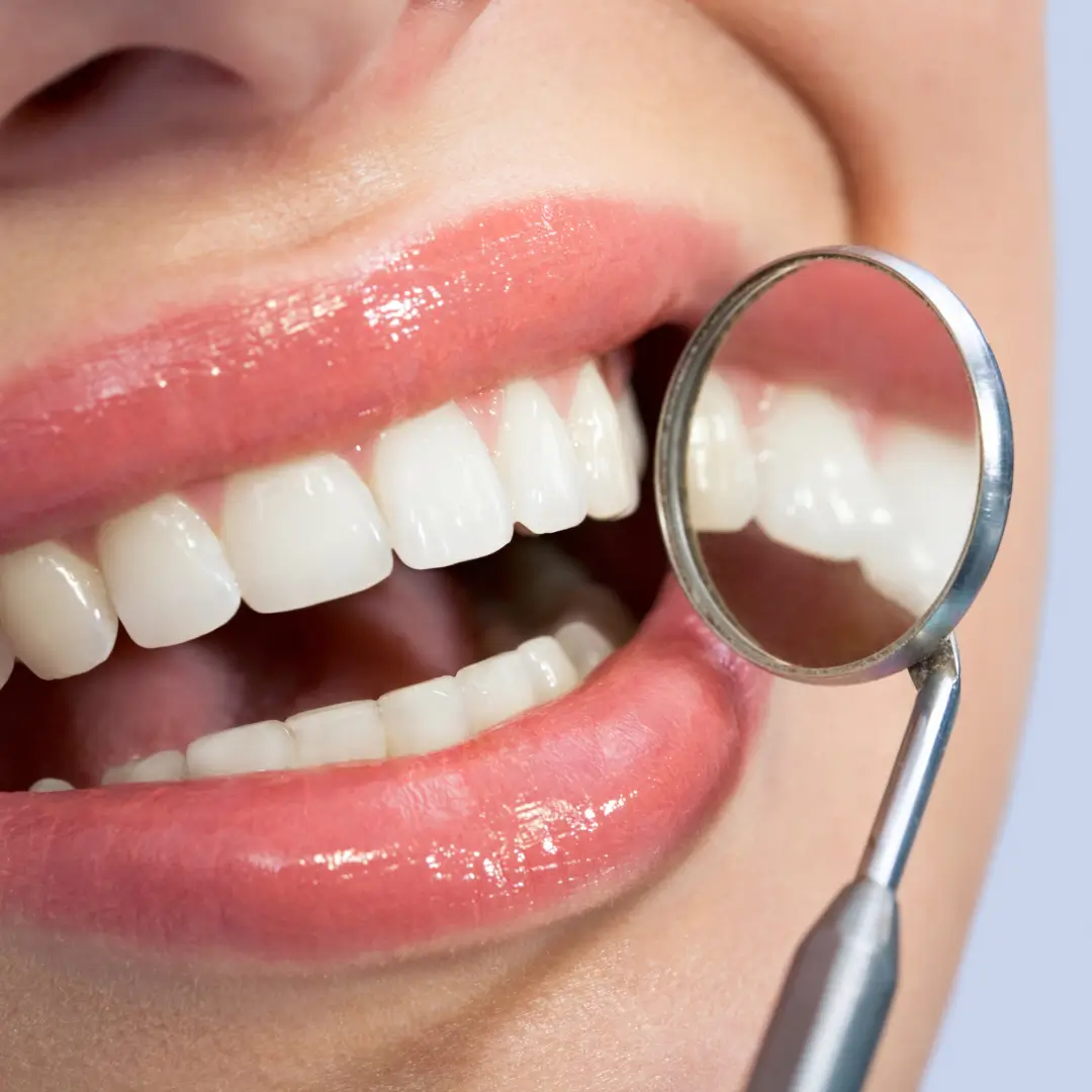 https://vistaridgedental.com/wp-content/uploads/2025/10/cosmetic-bonding-1.webp