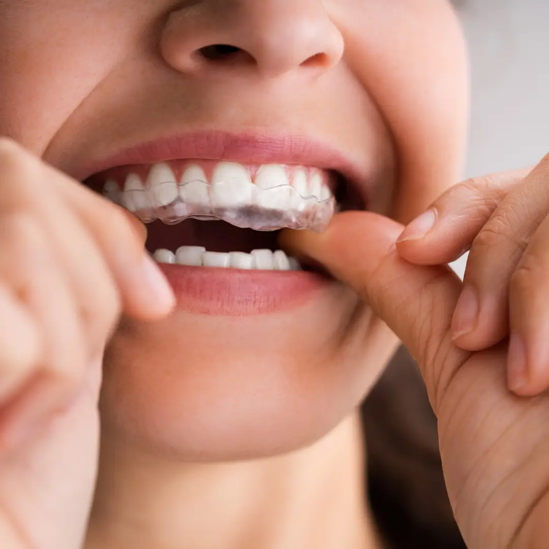 https://vistaridgedental.com/wp-content/uploads/2025/10/orthodontics-2-1.webp