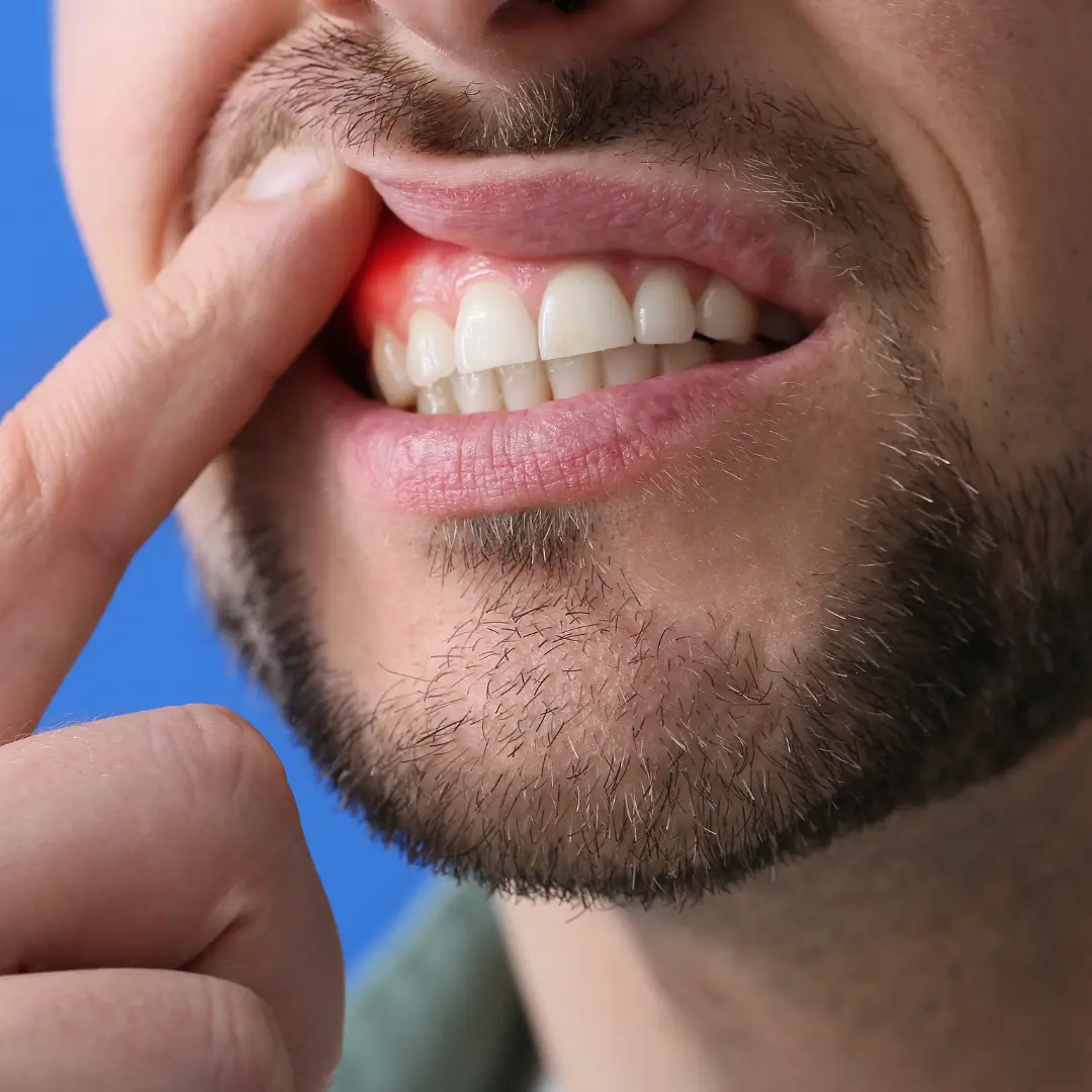 https://vistaridgedental.com/wp-content/uploads/2025/10/periodontal-2-1.webp